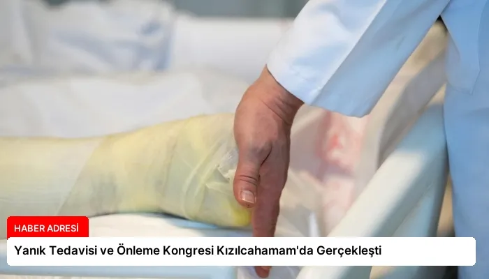Yanık Tedavisi ve Önleme Kongresi Kızılcahamam’da Gerçekleşti